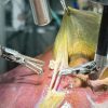 Pela 1ª vez na história, robô faz cirurgia guiado por IA sem ajuda humana