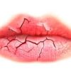 O que os lábios ressecados podem dizer?